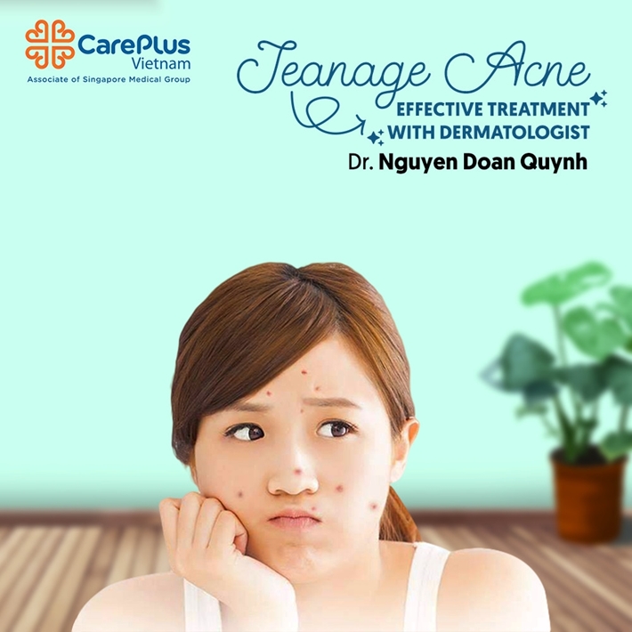 Teanage Acne: Effective treatment with Dermatologist