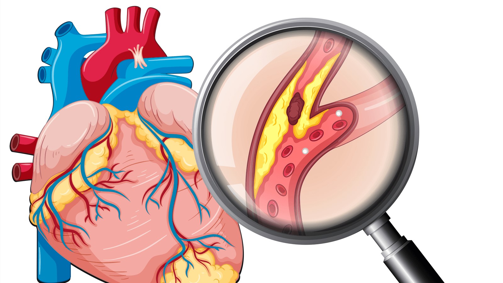 Các bệnh tim mạch thường gặp và triệu chứng