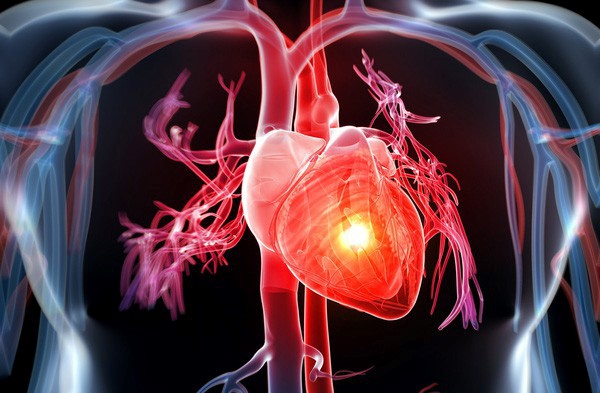 Khám và tầm soát tim mạch định kỳ, tránh nhiều hậu quả đáng tiếc